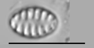 Staurosirella neopinnata LM7