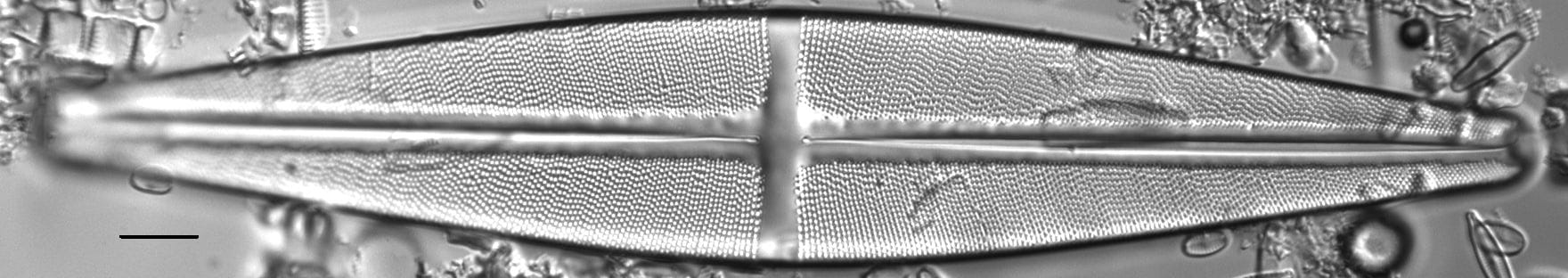 Stauroneis phoenicenteron LM5