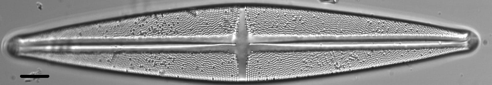 Stauroneis phoenicenteron LM2