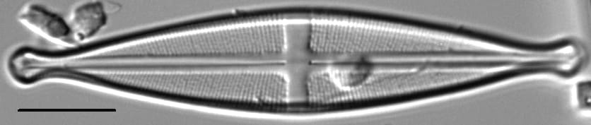 Stauroneis pikuni LM6