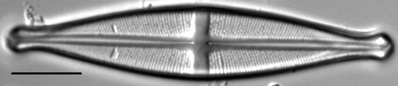 Stauroneis pikuni LM2