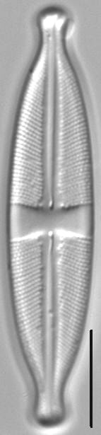 Stauroneis reichardtii LM3