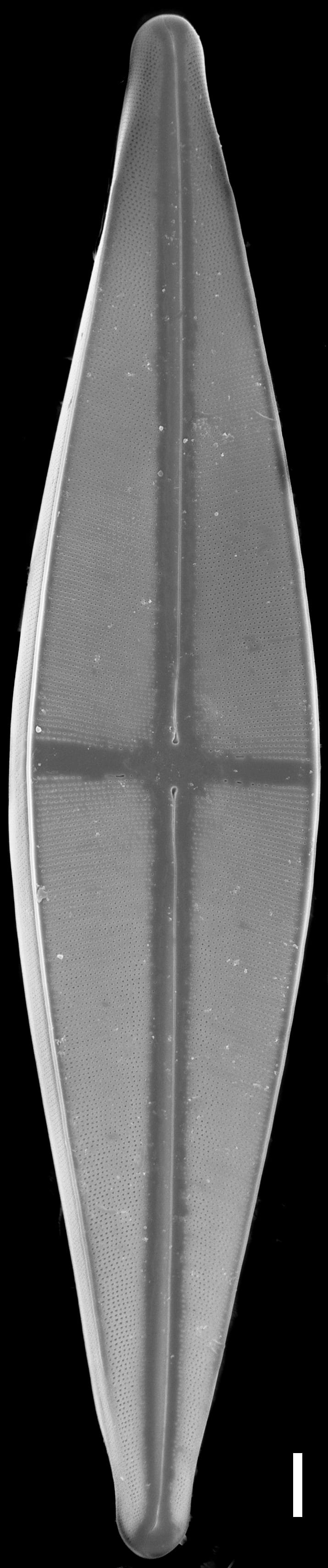 Stauroneis baileyi SEM1 Cedar Muck140 021