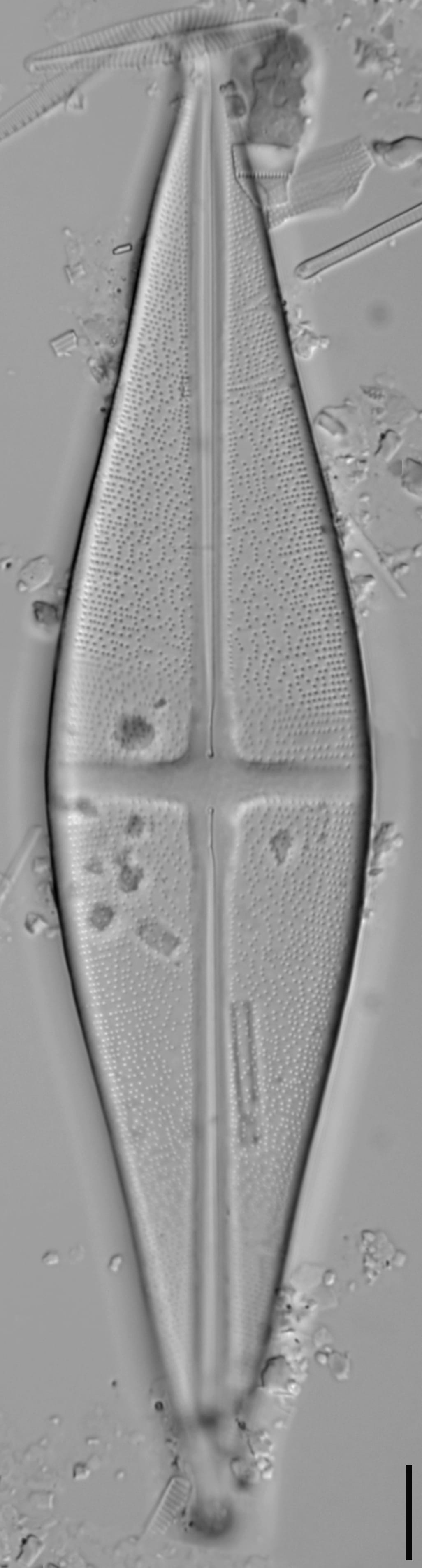 Stauroneis nobilis LM1