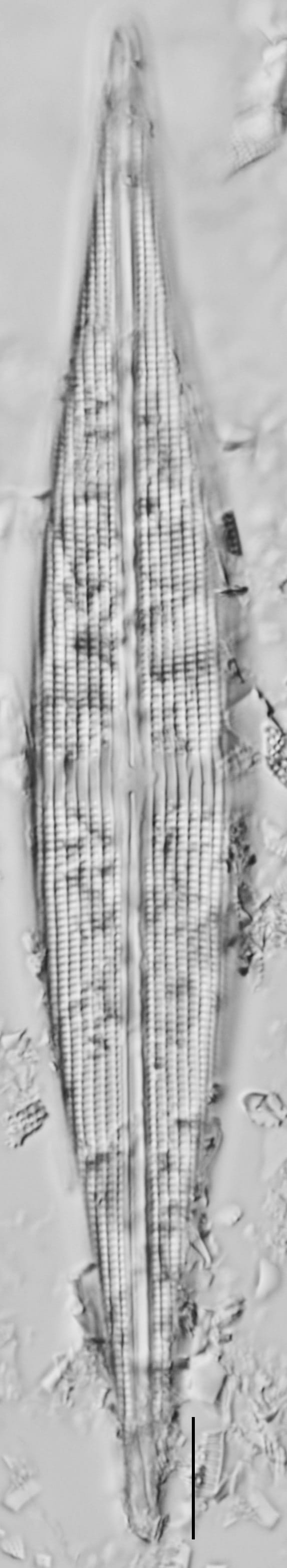 Stauroneis staurolineata LM8