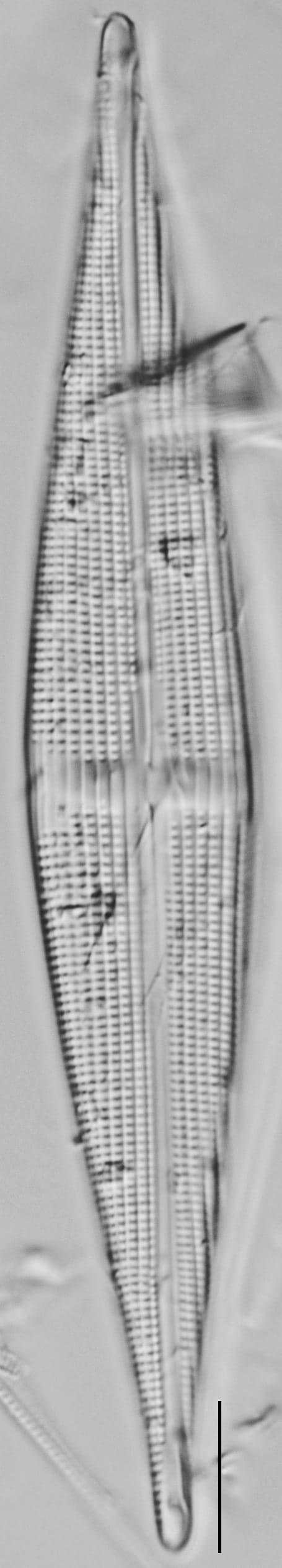 Stauroneis staurolineata LM6