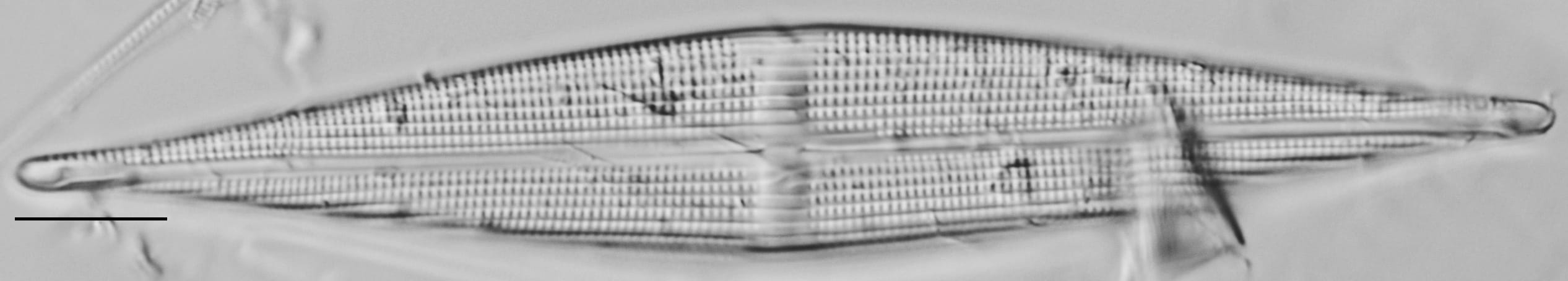 Stauroneis staurolineata LM6