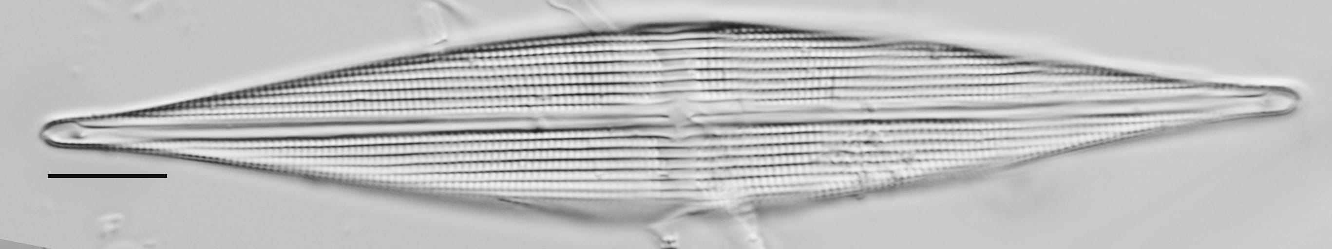 Stauroneis staurolineata LM5