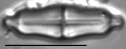 Stauroneis separanda LM5