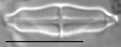 Stauroneis separanda LM4
