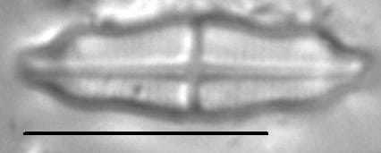 Stauroneis separanda LM3
