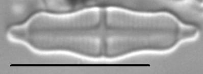 Stauroneis separanda LM1