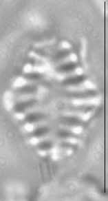 Staurosira construens LM5