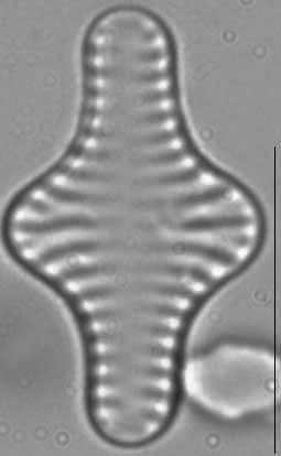 Staurosira construens LM1