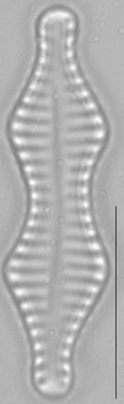 Staurosira construens var binodis LM1