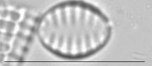 Staurosira construens var venter LM4