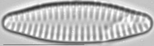 Staurosira construens var venter LM3