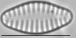 Staurosira construens var venter LM2