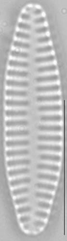 Staurosira construens var venter LM1