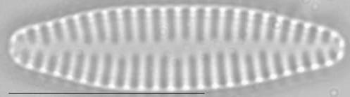 Staurosira construens var venter LM1