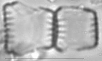 Staurosira construens var venter LM5