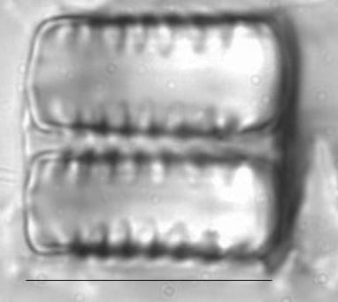 Staurosirella leptostauron LM5