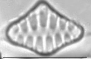 Staurosirella leptostauron LM3