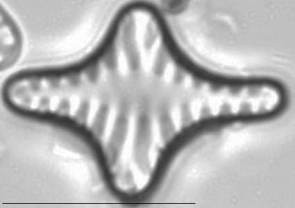 Staurosirella leptostauron LM2