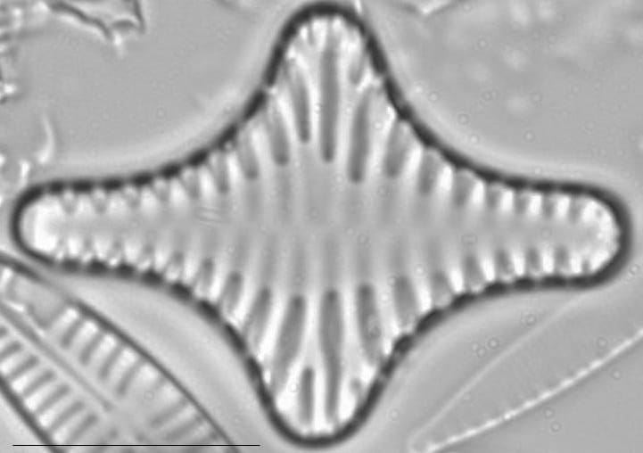 Staurosirella leptostauron LM1