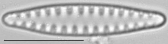 Staurosirella leptostauron var dubia LM4