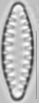 Staurosirella leptostauron var dubia LM3