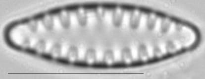Staurosirella leptostauron var dubia LM3