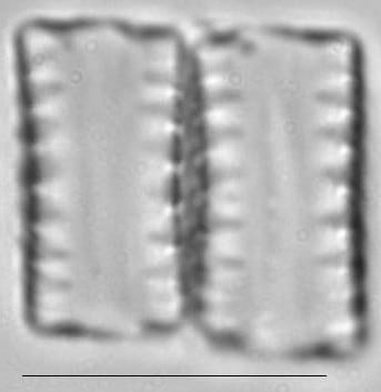 Staurosirella leptostauron var dubia LM2