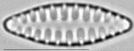 Staurosirella leptostauron var dubia LM1