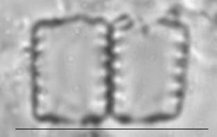 Staurosirella pinnata LM2