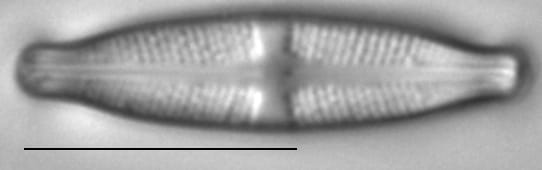 Stauroneis kriegeri LM1
