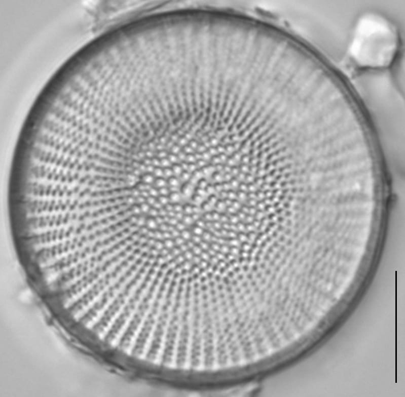 Stephanodiscus medius LM7