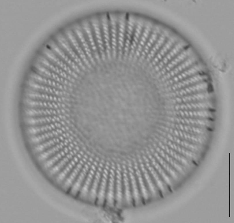 Stephanodiscus medius LM6
