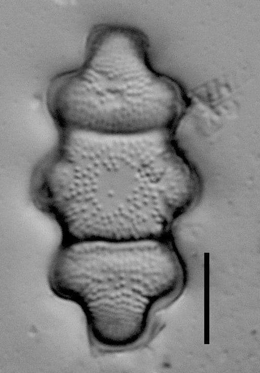 Stoermeria americana LM1