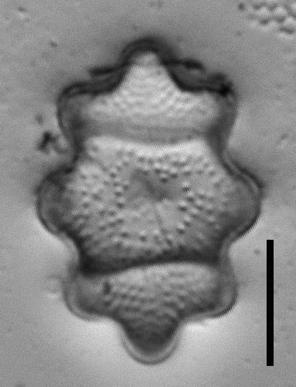 Stoermeria americana LM2