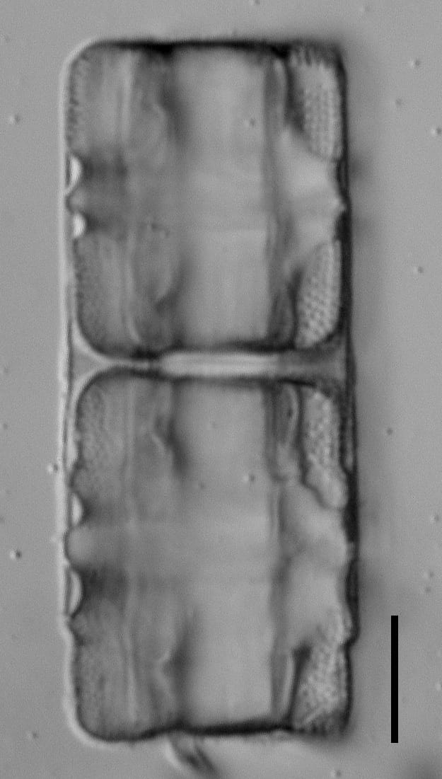 Stoermeria americana LM5
