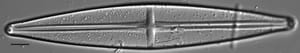 Stauroneis supergracilis LM11