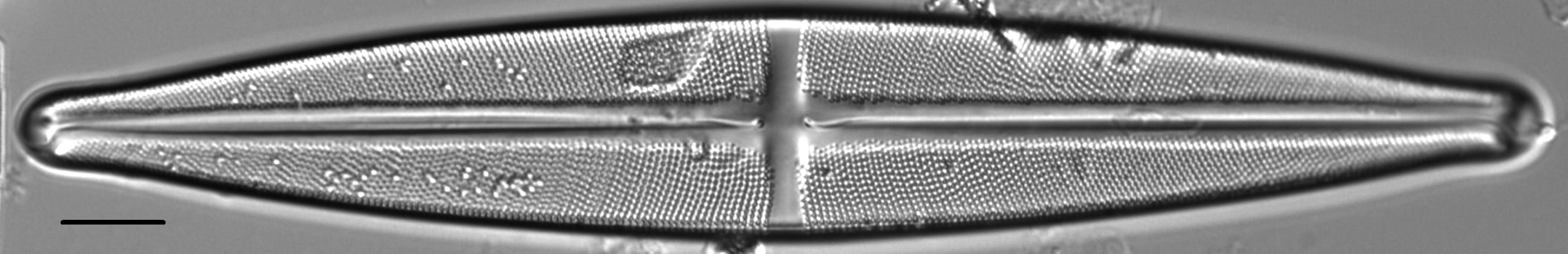 Stauroneis supergracilis LM10