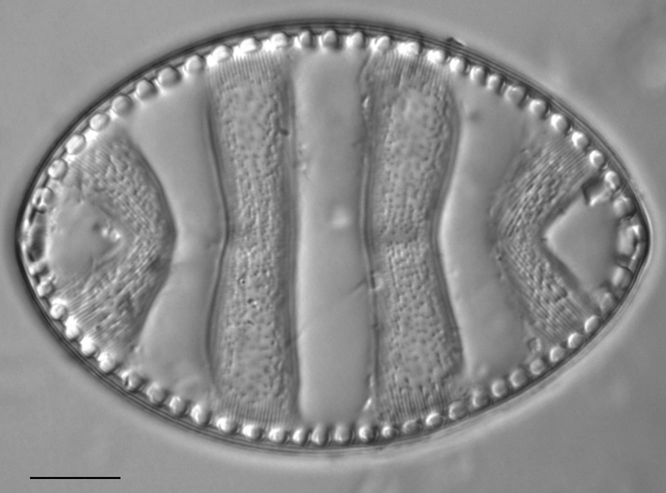 Surirella undulata LM7