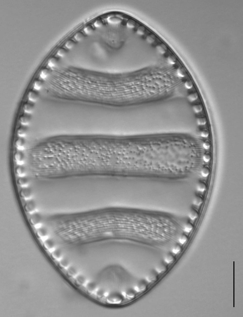 Surirella undulata LM6