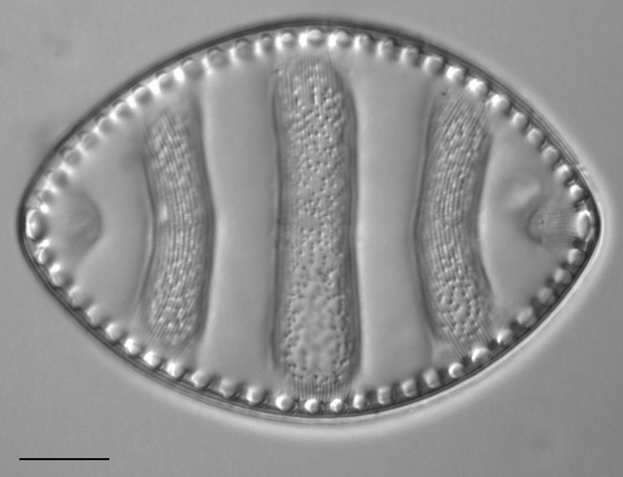 Surirella undulata LM6