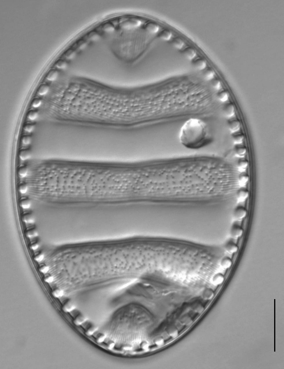 Surirella undulata LM5
