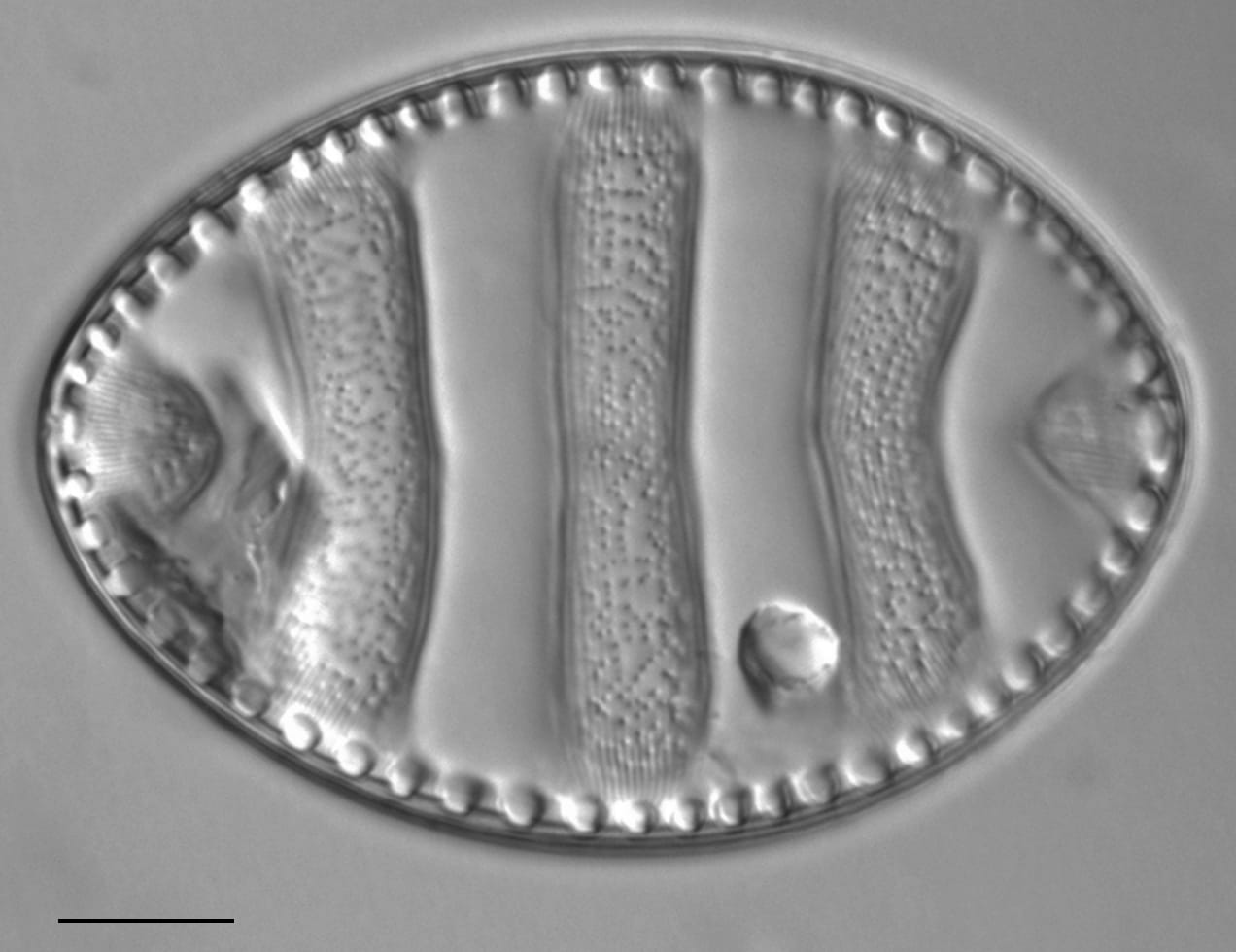 Surirella undulata LM5