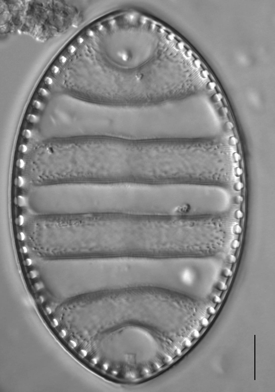 Surirella undulata LM4