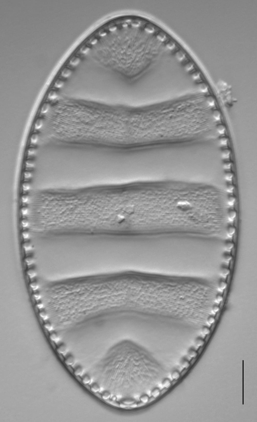 Surirella undulata LM3